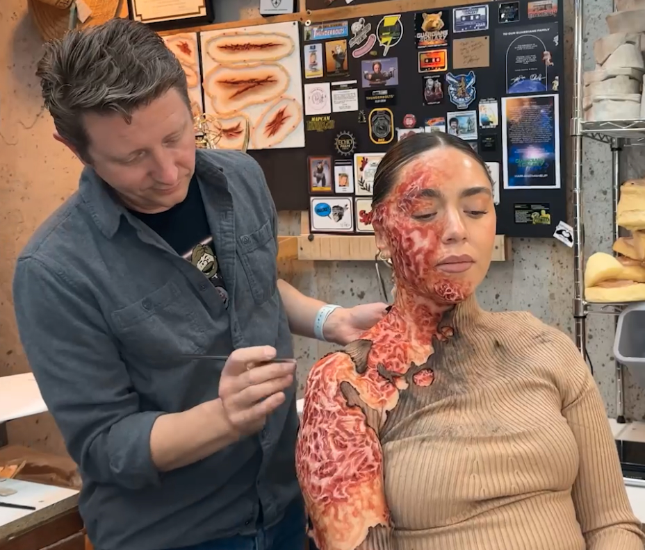 Applying prosthetic burn makeup